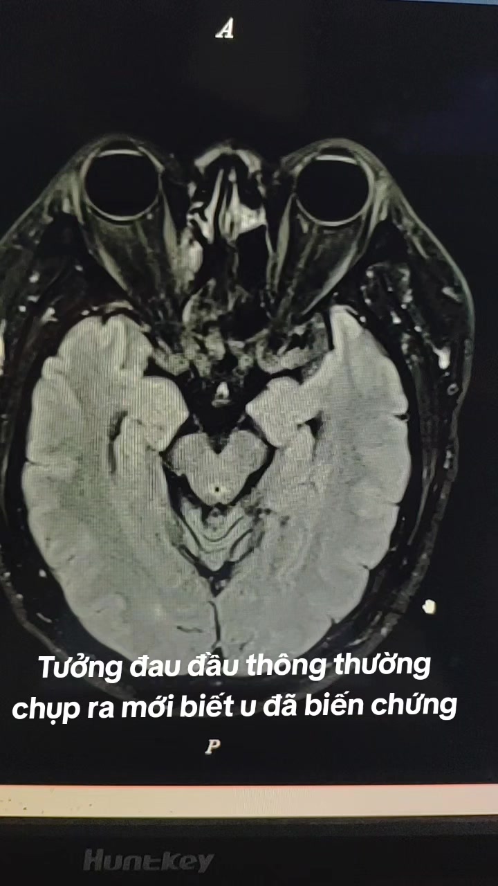 @Nguyễn Văn T&ugrave;ng