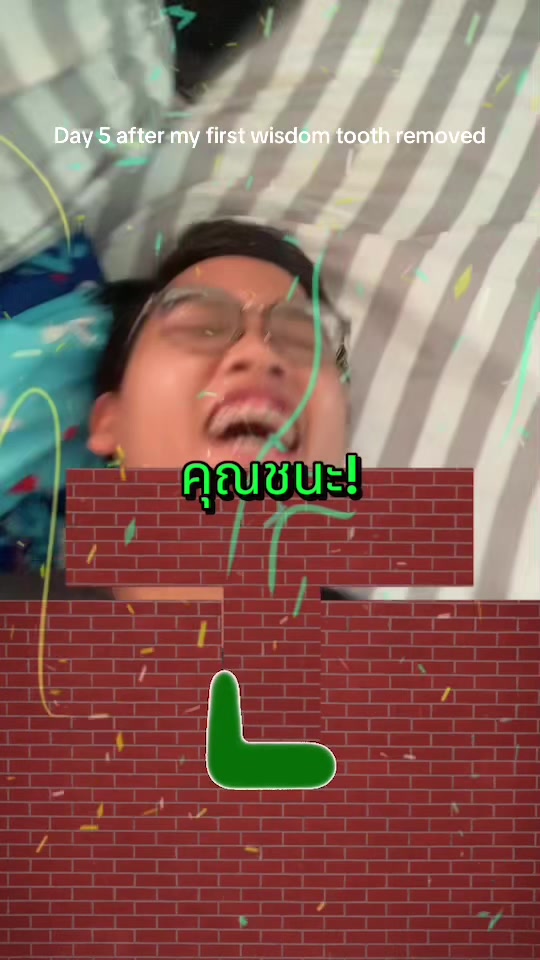 @MisterOX