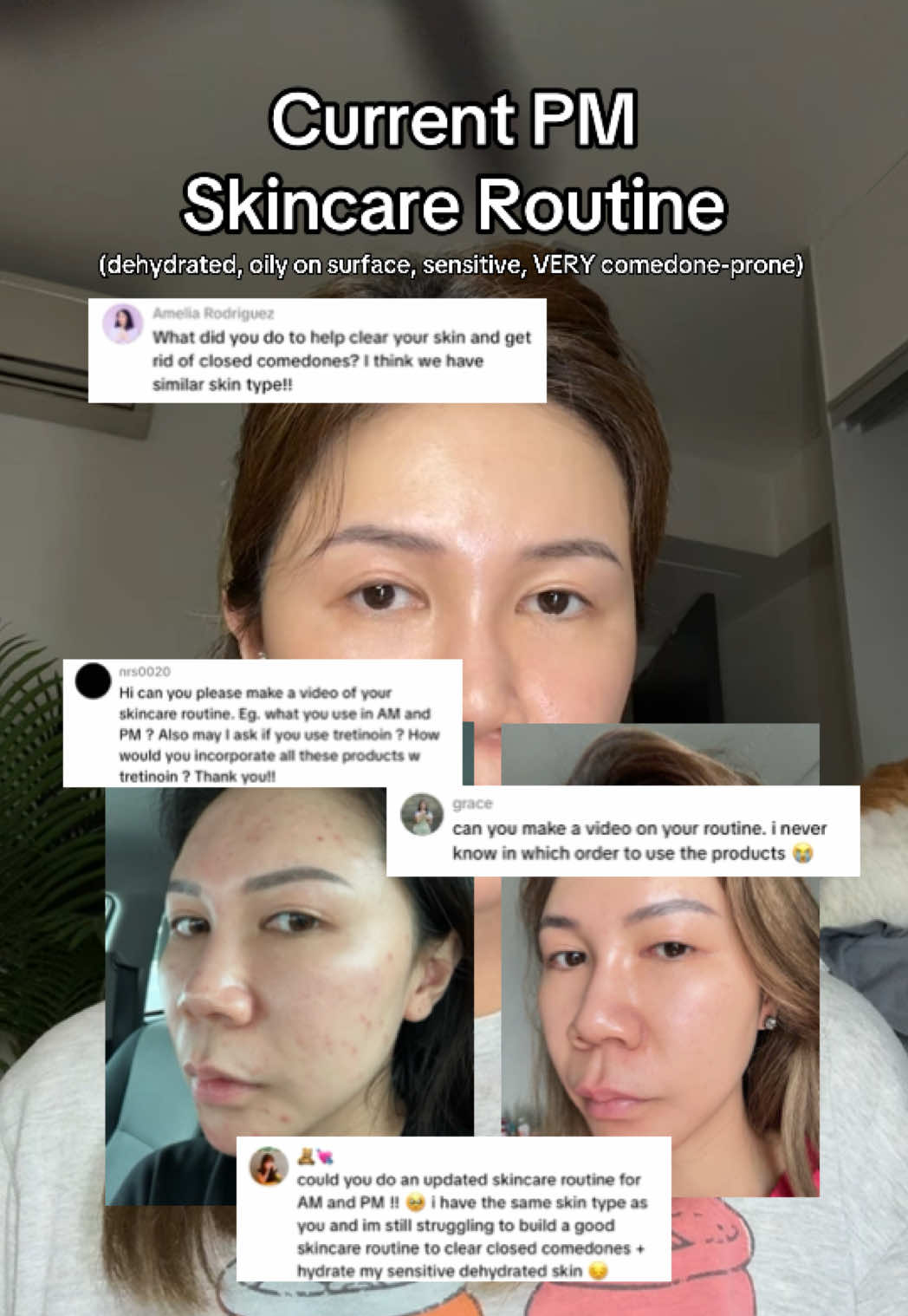 @watermelyn | skin+life