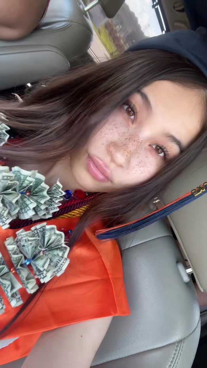 @freckleface2222