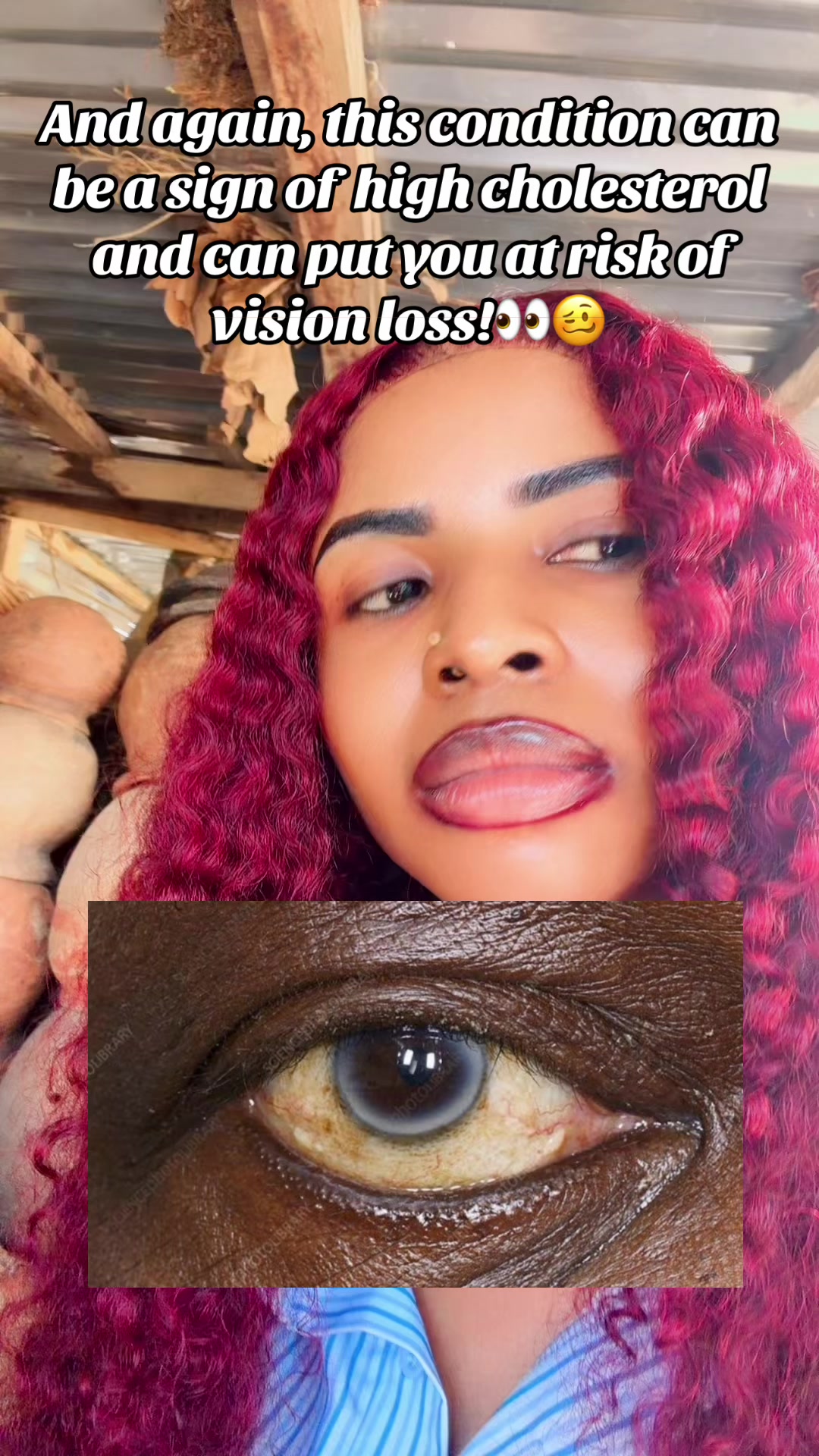 @GeNz_alagbo🐍🍯