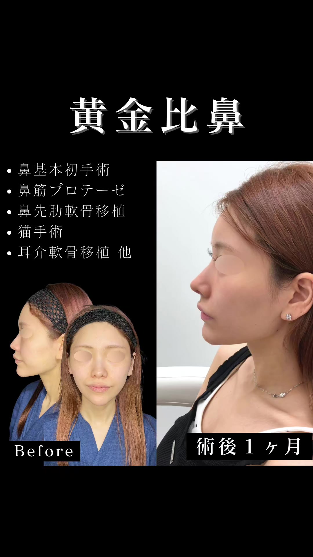 @ソ院長(バウム美容外科/トータル整形)