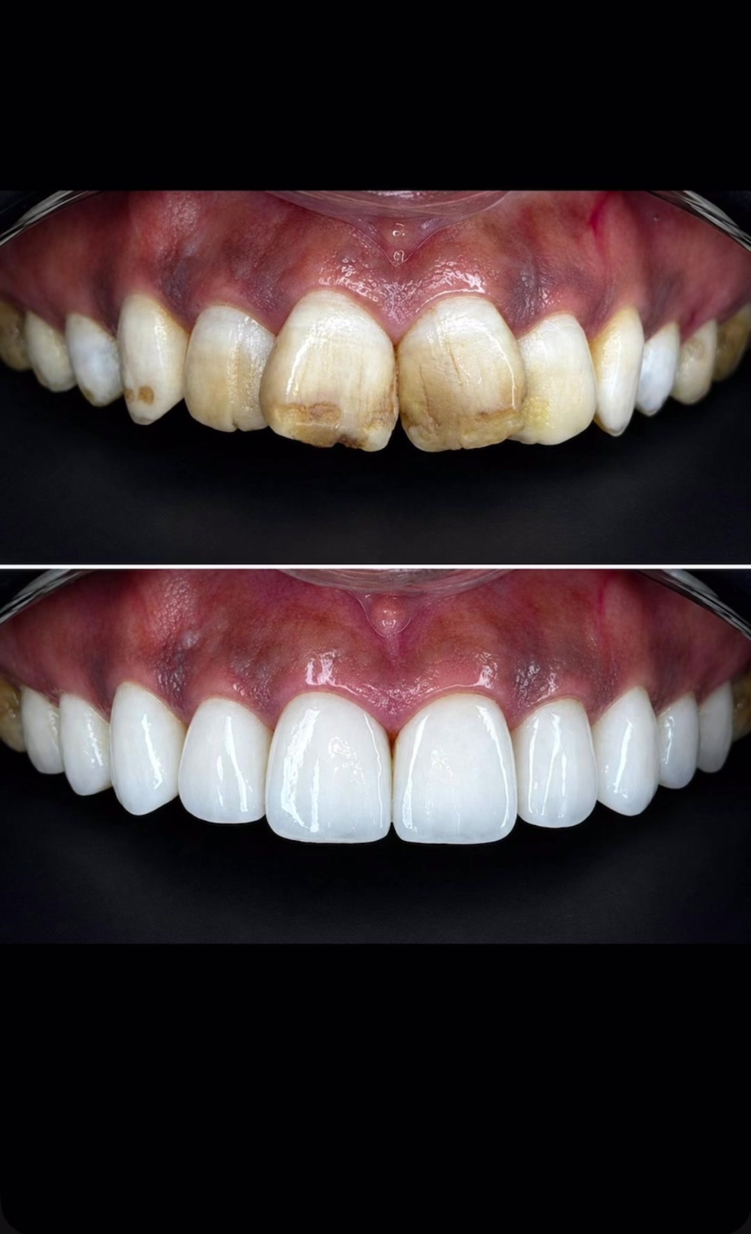 @drhelina_smile_architect