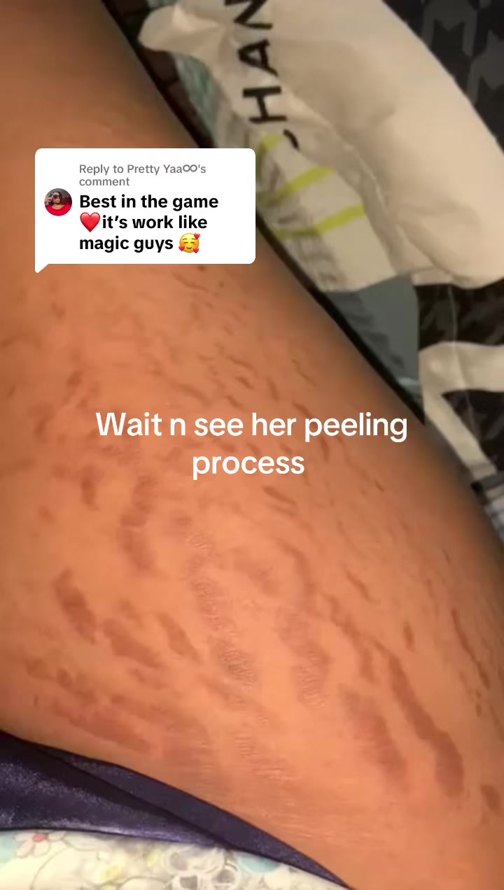 @@ Precious peeling soap