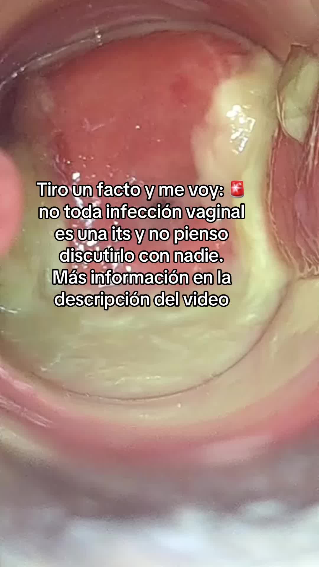 @OBST. KEYLA SALTOS
