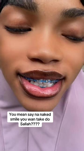 @Braces.bymavi|Smile Aesthetics