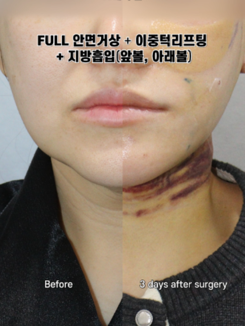 @다시피움성형외과 DASIPIUM タシピウム