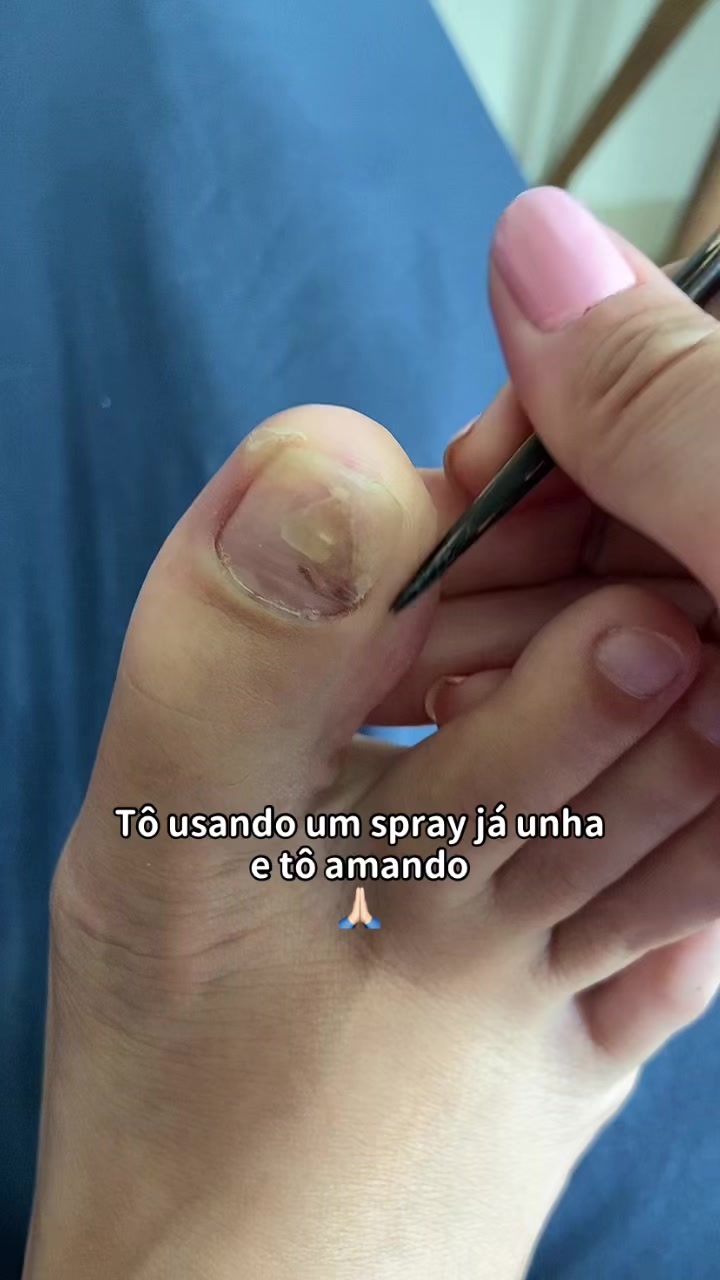 @Carolinaindica