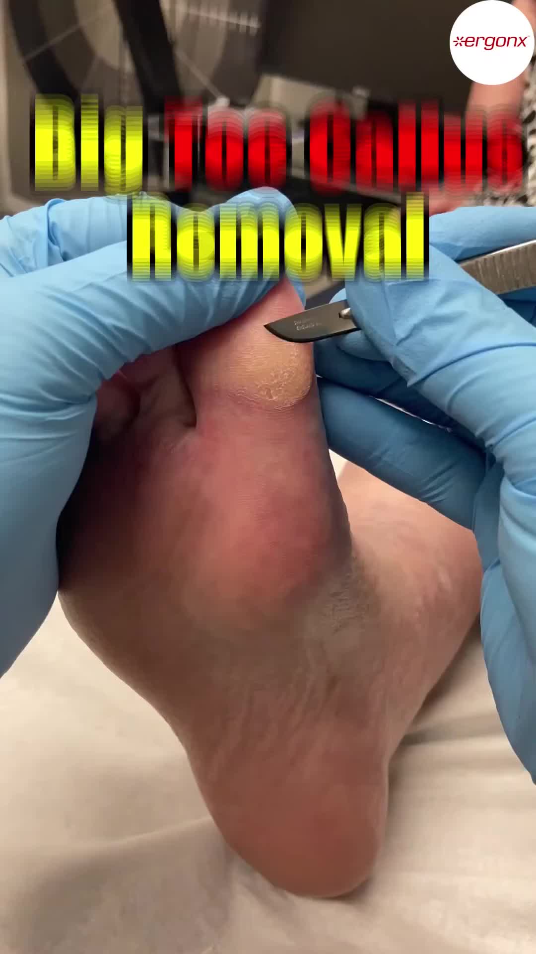 @ergonx