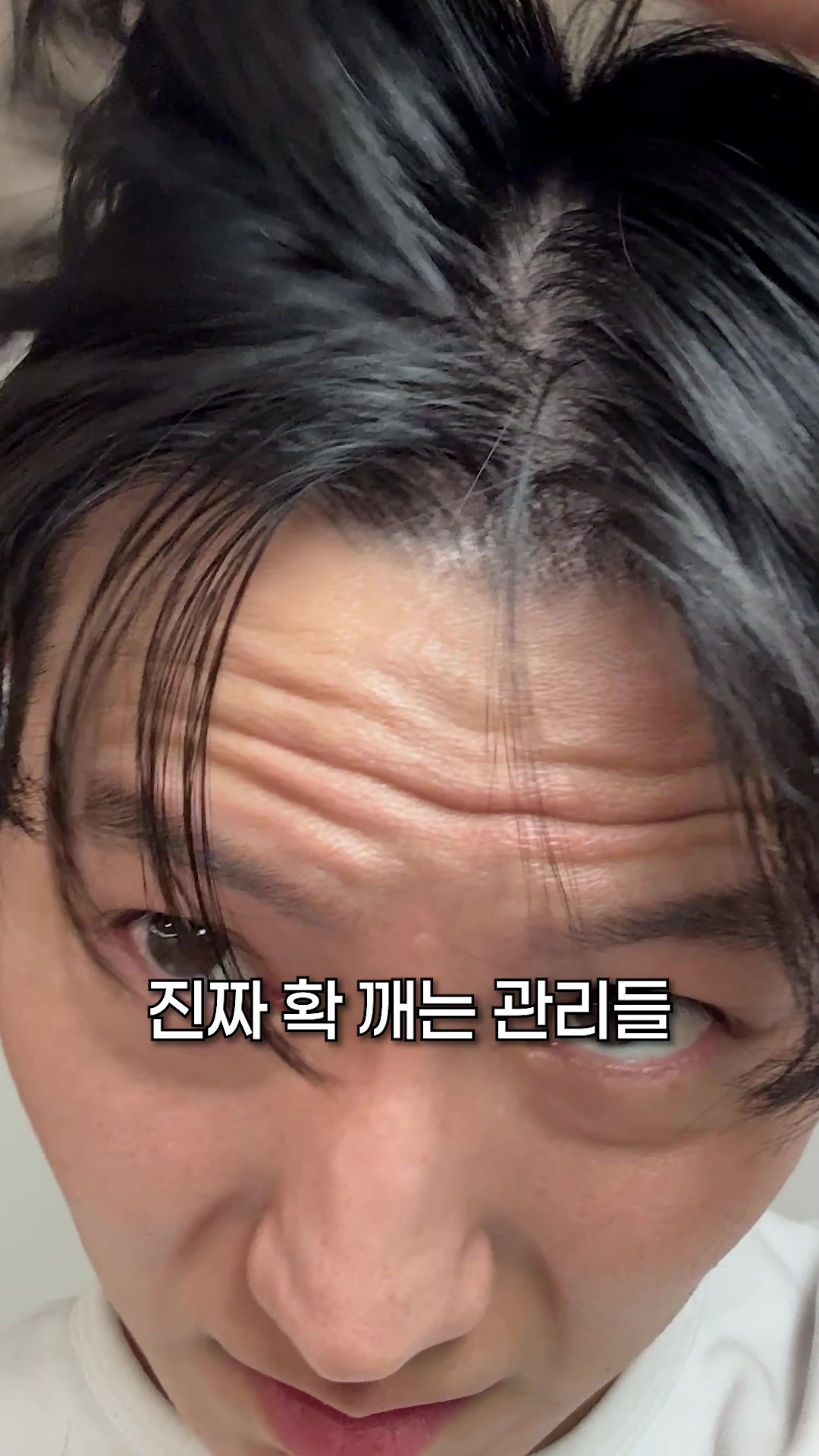 @비트 BTE