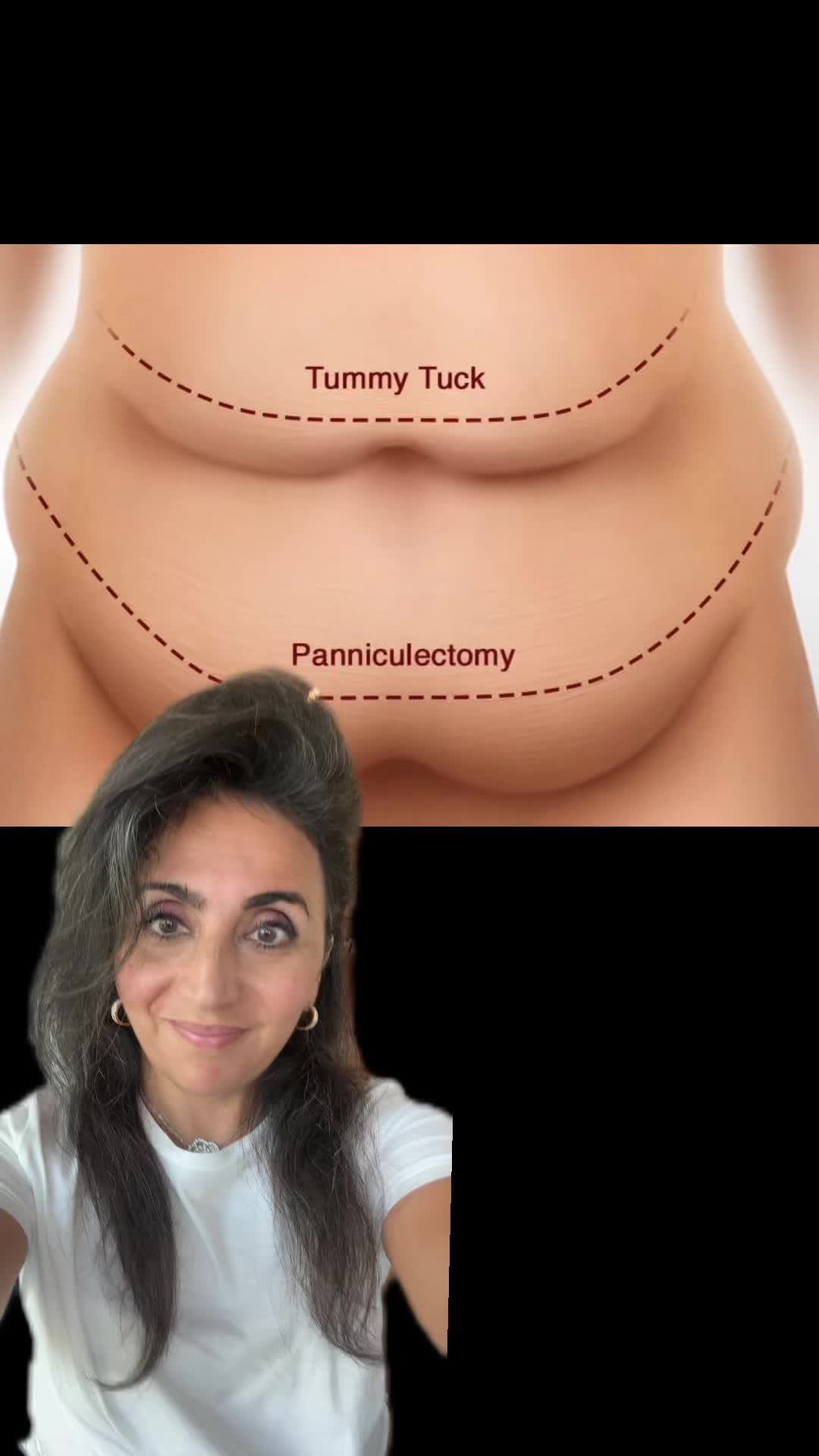 @AESTHETICA LA -Dr.Yaghoubian