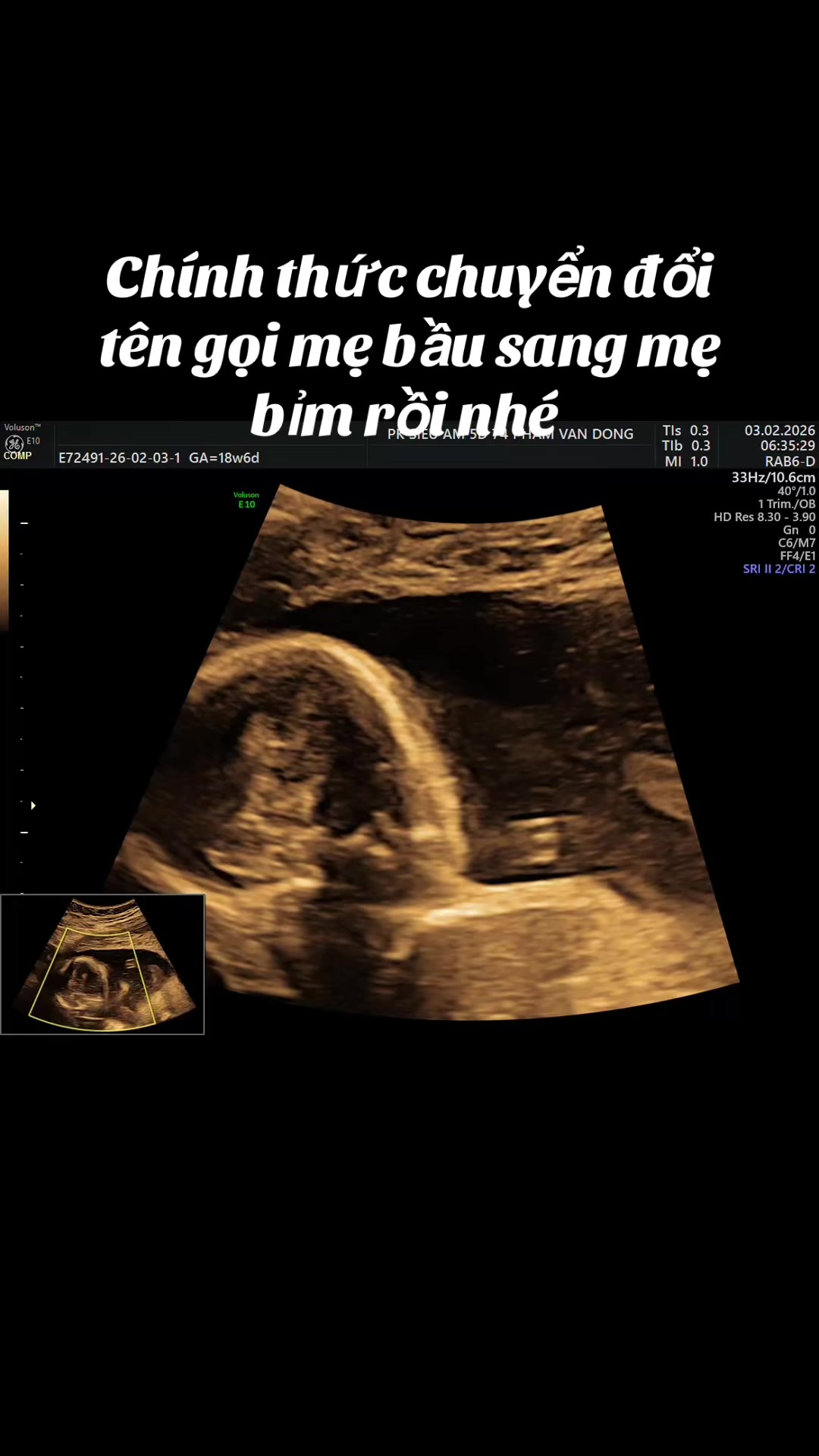 @🍀U40 làm mẹ 🦓🦓