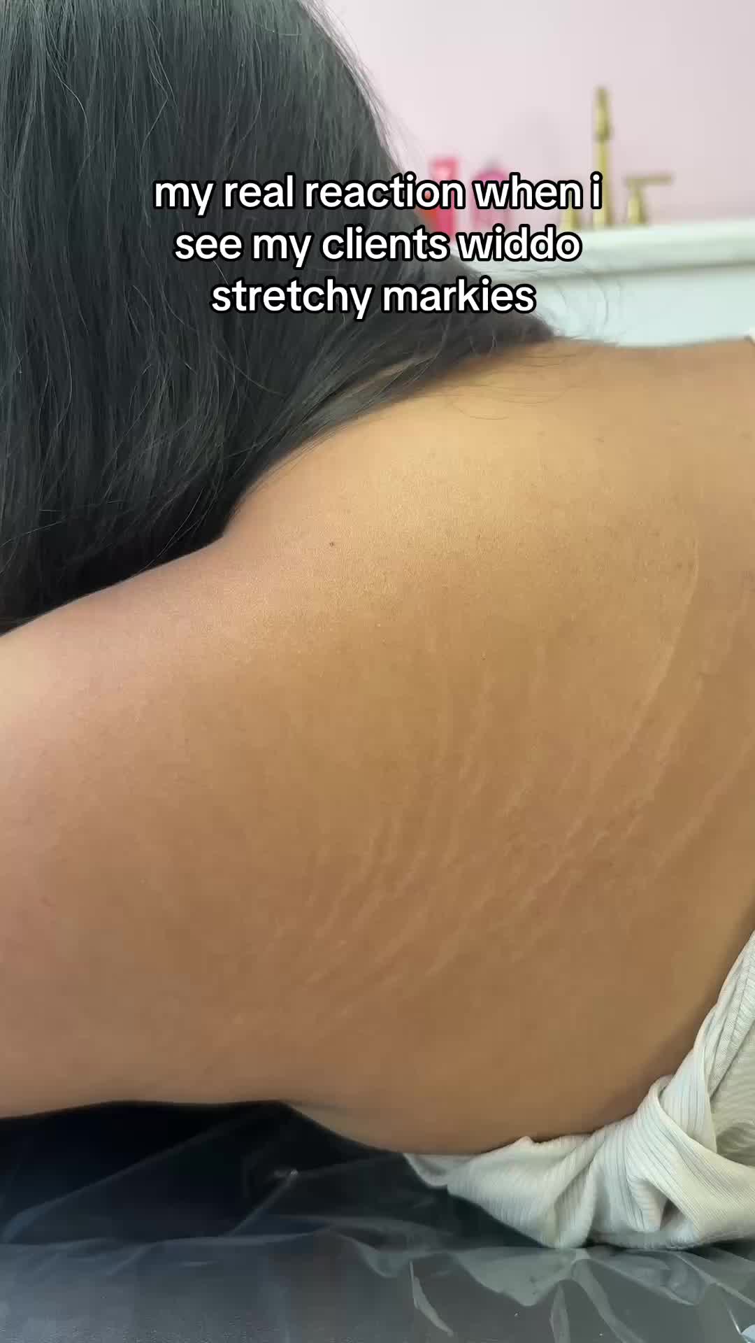 @Stretch Mark Fairy 🧚✨