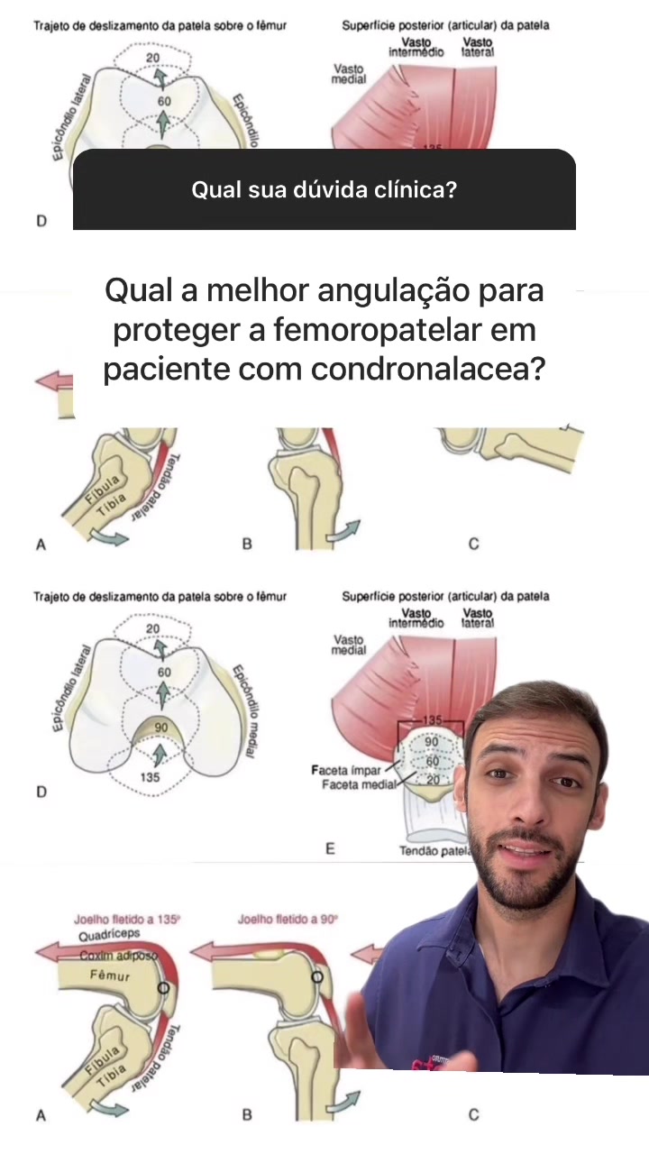 @Vinicius Titico