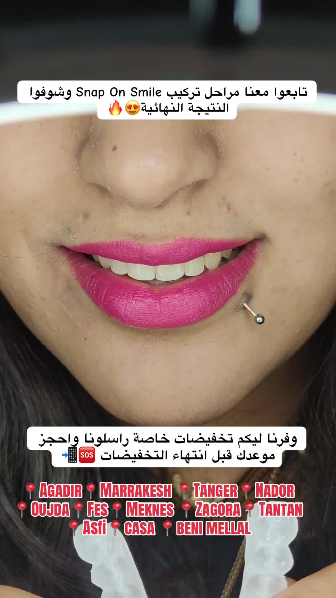 @brightsmileee1