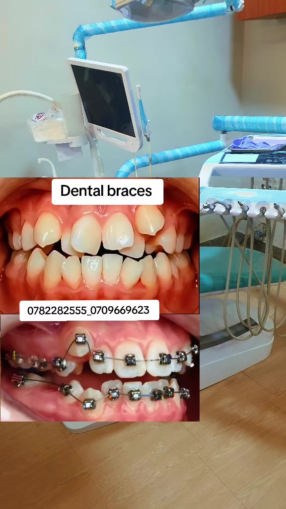 @@KAI Dentalcare123kampala