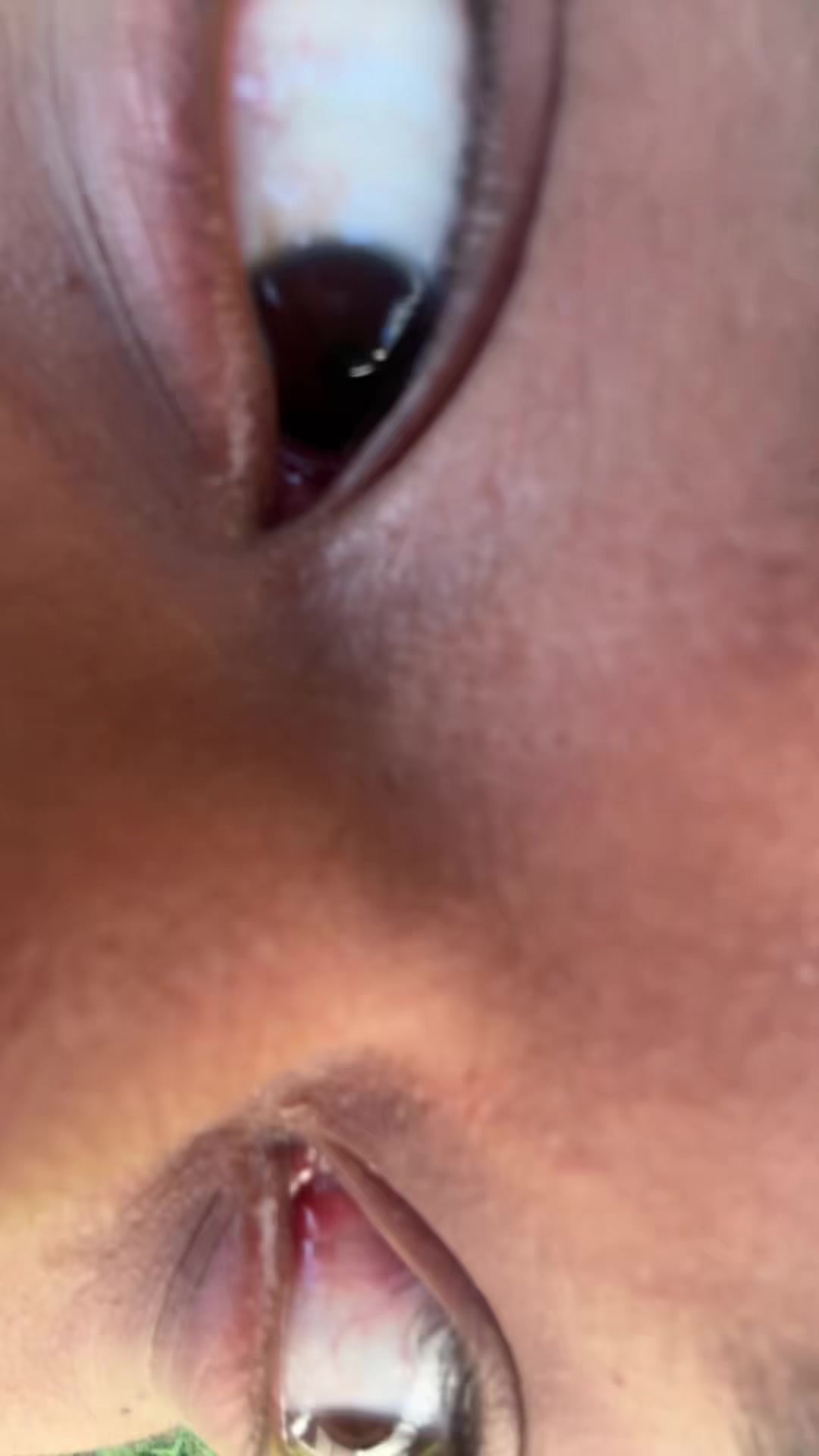 @Xlazy