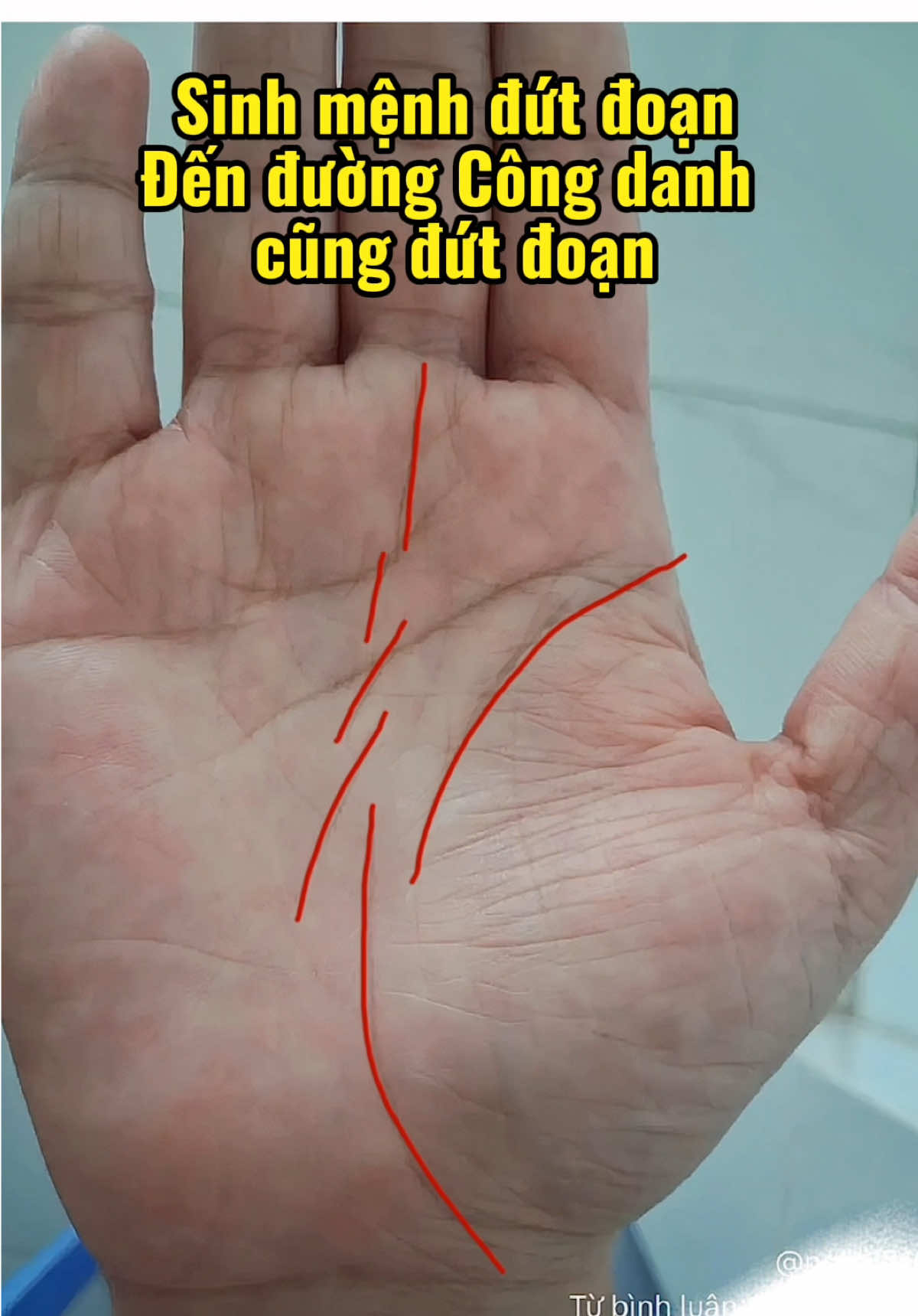 @VẬN MỆNH RADIO