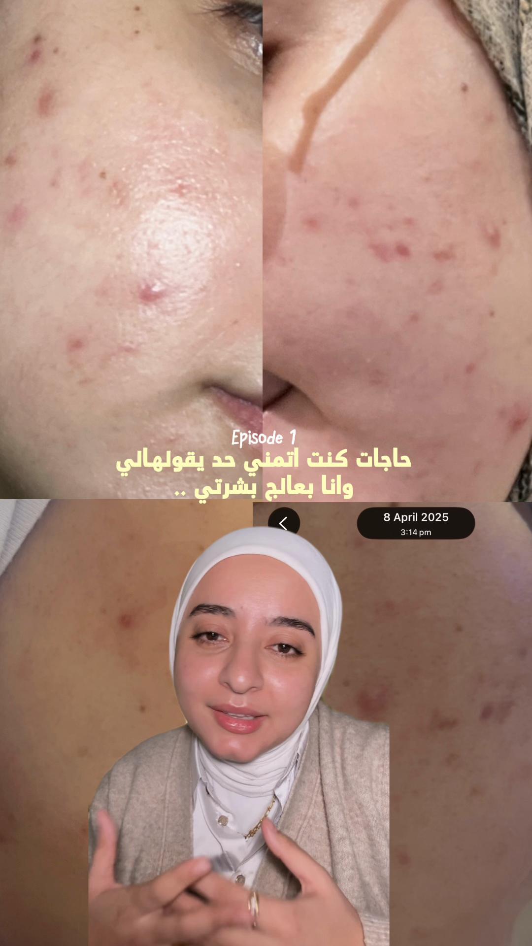 @Dr MeNna ali