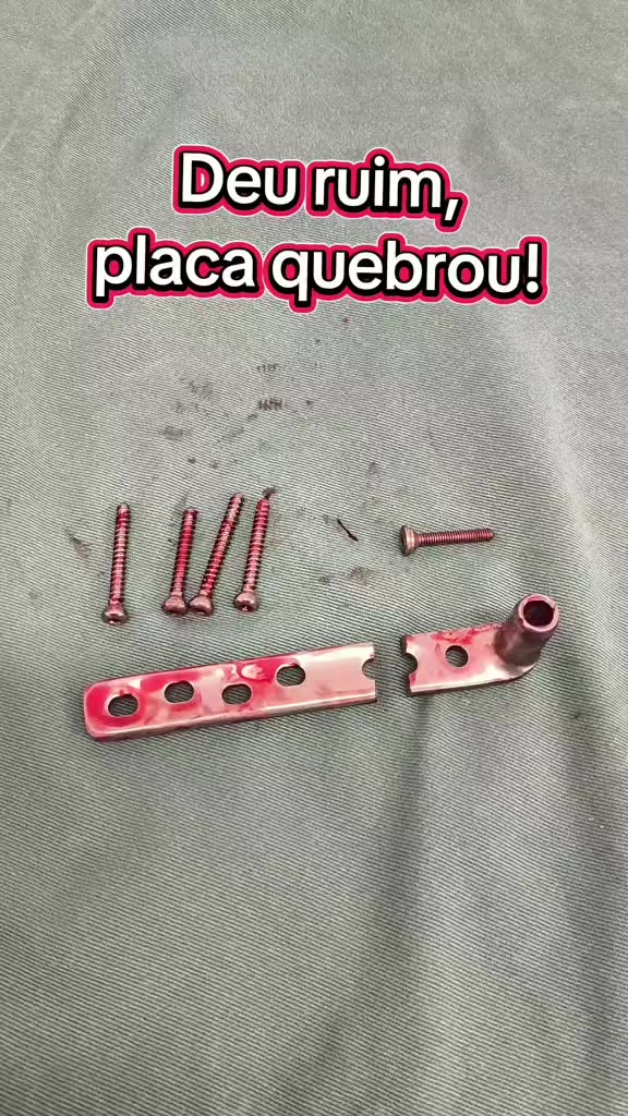 @Carlos | Instrumentador Orto