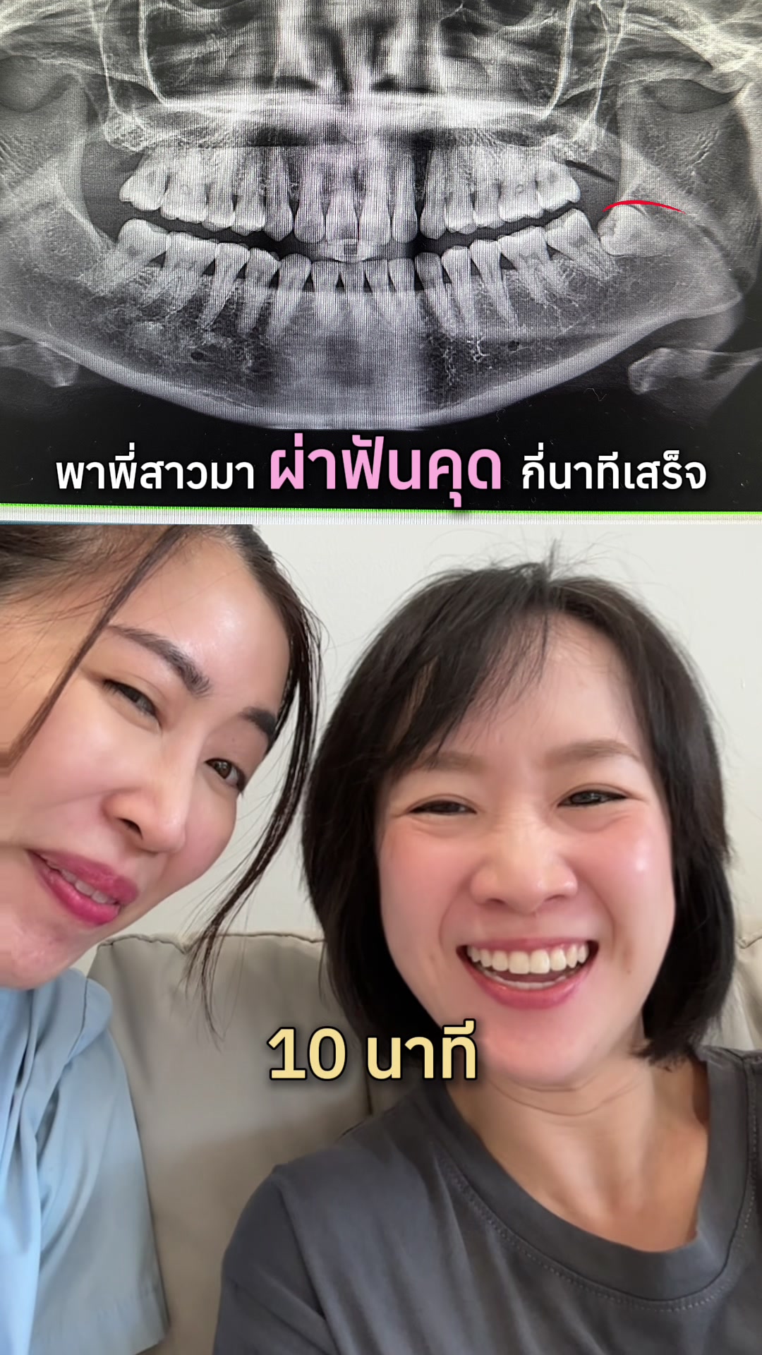 @ณัฐคุณ (Nuttakul Dent) 🦷