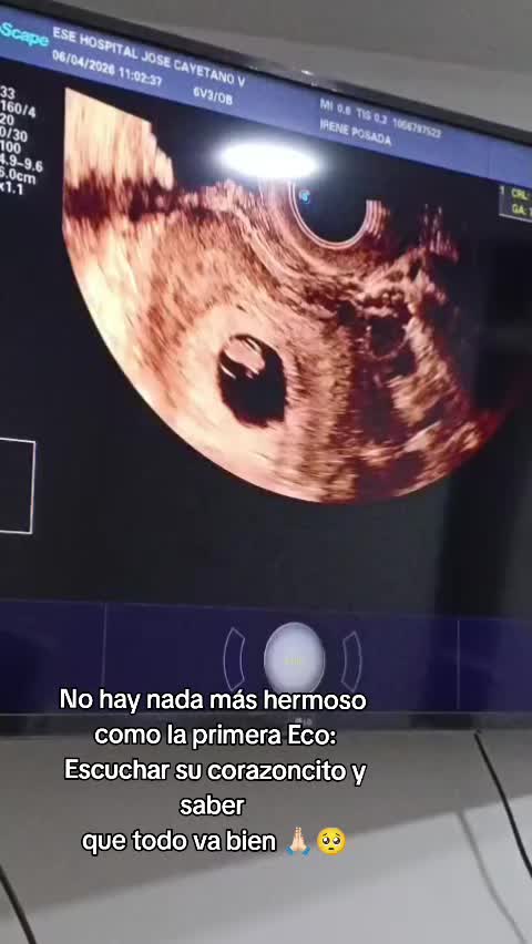 @IRENE 🫦💗