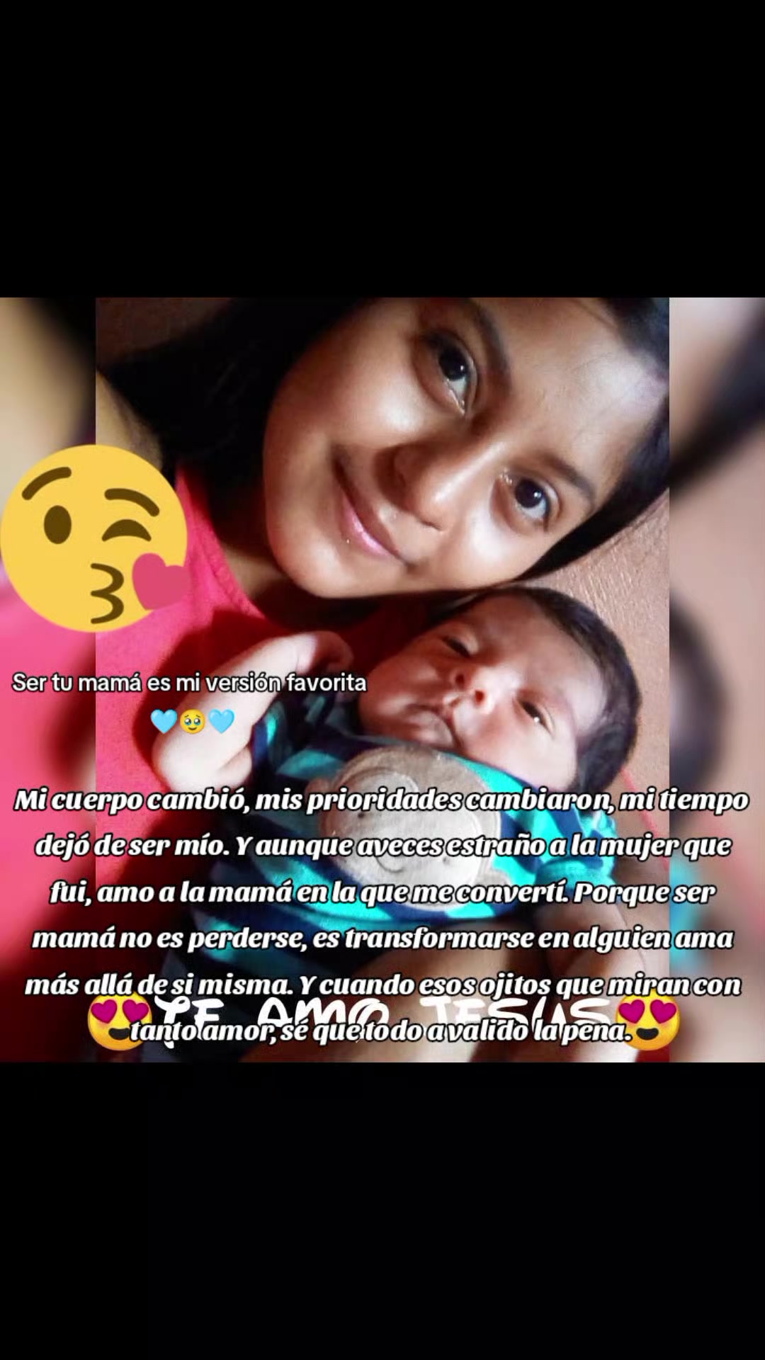 @🙈RN Janeth🙈