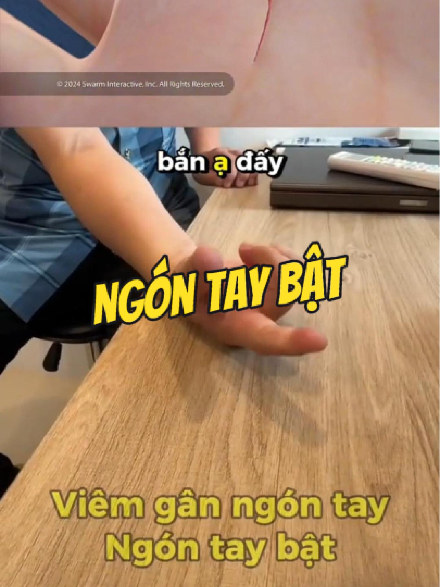 @Chuy&ecirc;n gia xương khớp