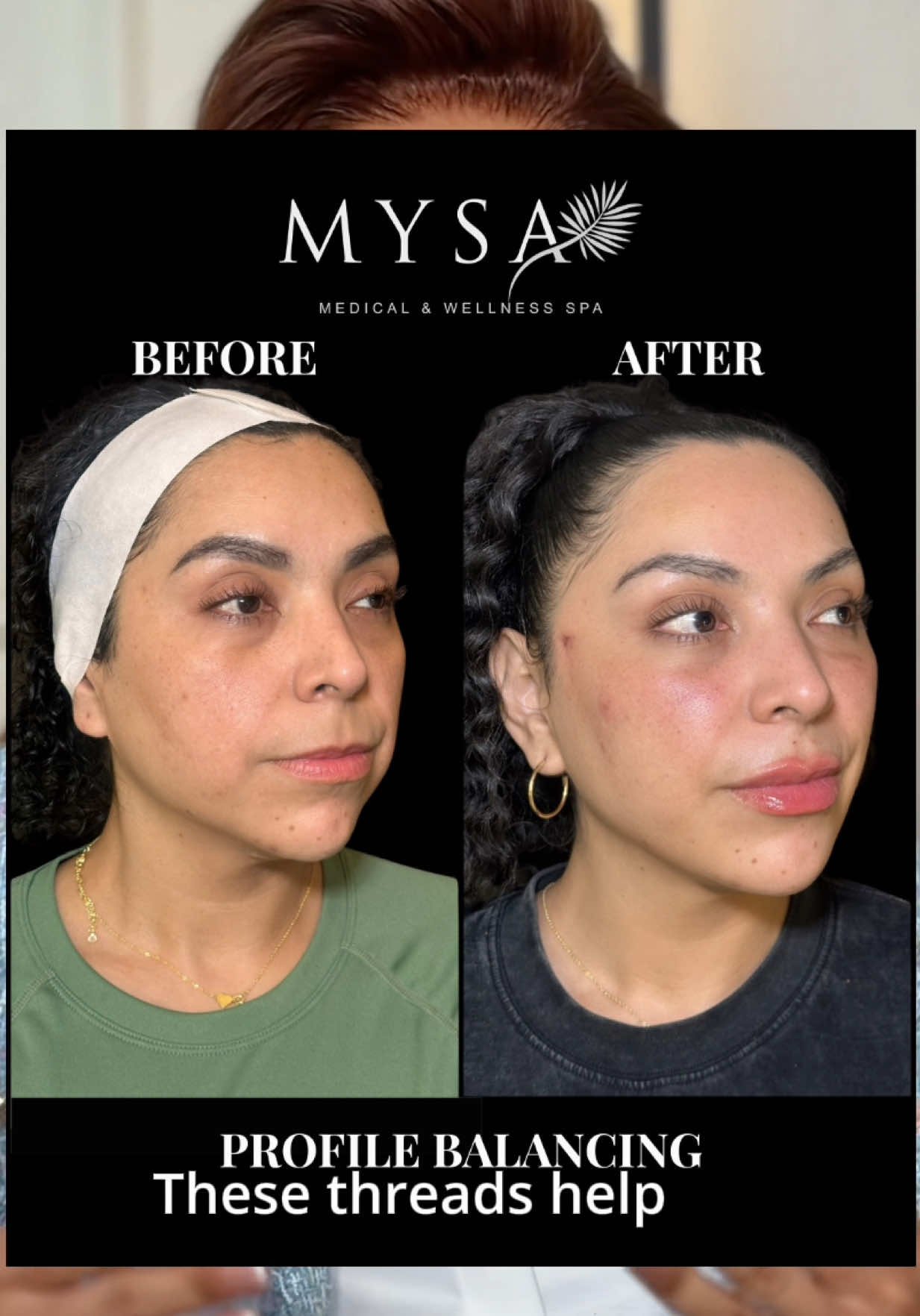 @Mysa Medical & Wellness Spa