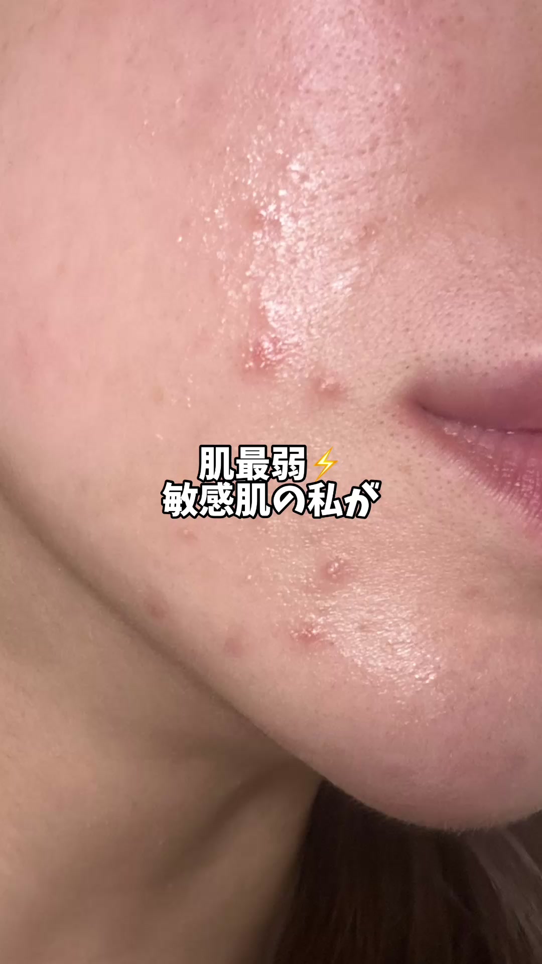@肌最弱ゆい🇰🇷韓国在住