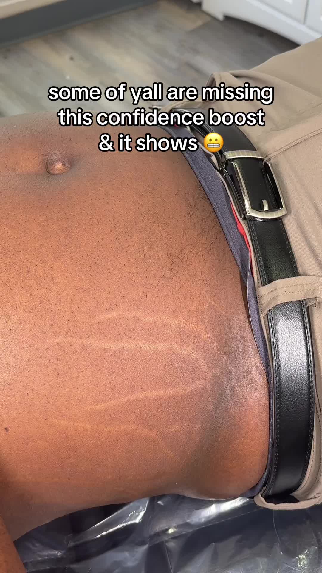 @Stretch Mark Fairy 🧚✨