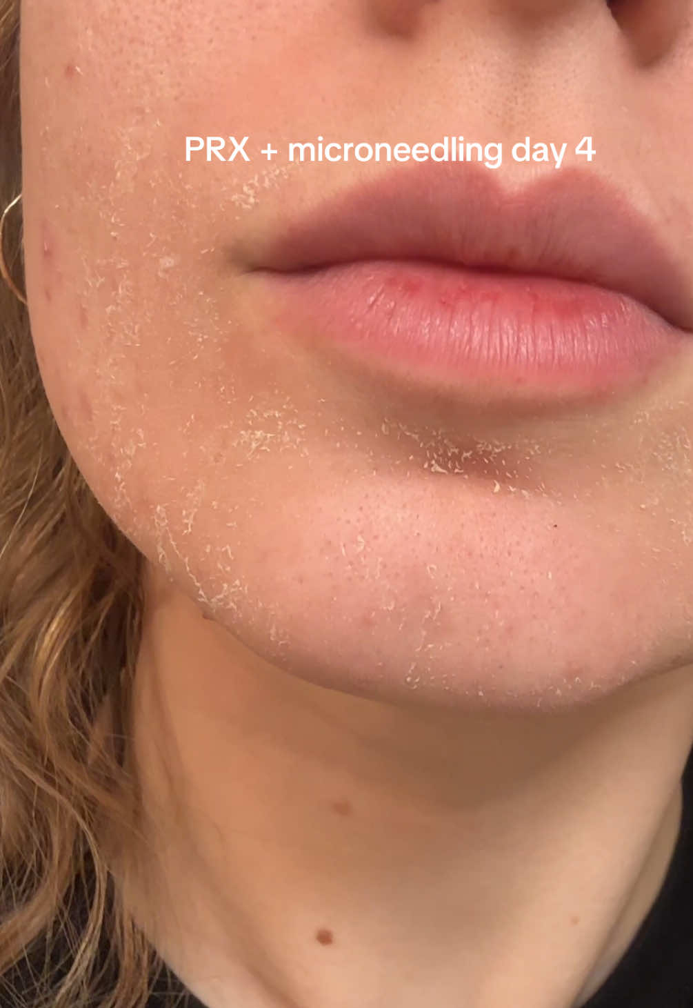 @Julie Manko || Esthetician