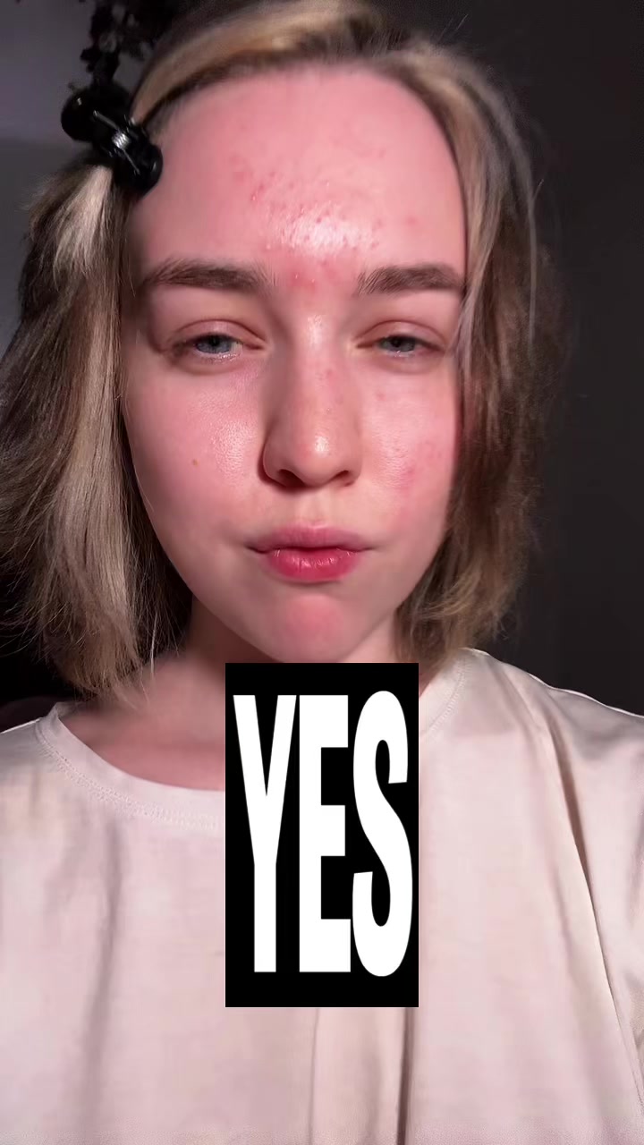 @its L