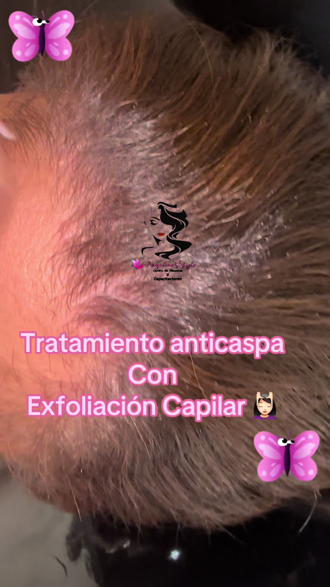 @Ang&eacute;lica Moncayo