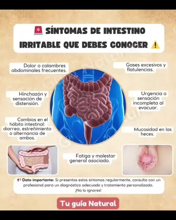 @SD Fonseca