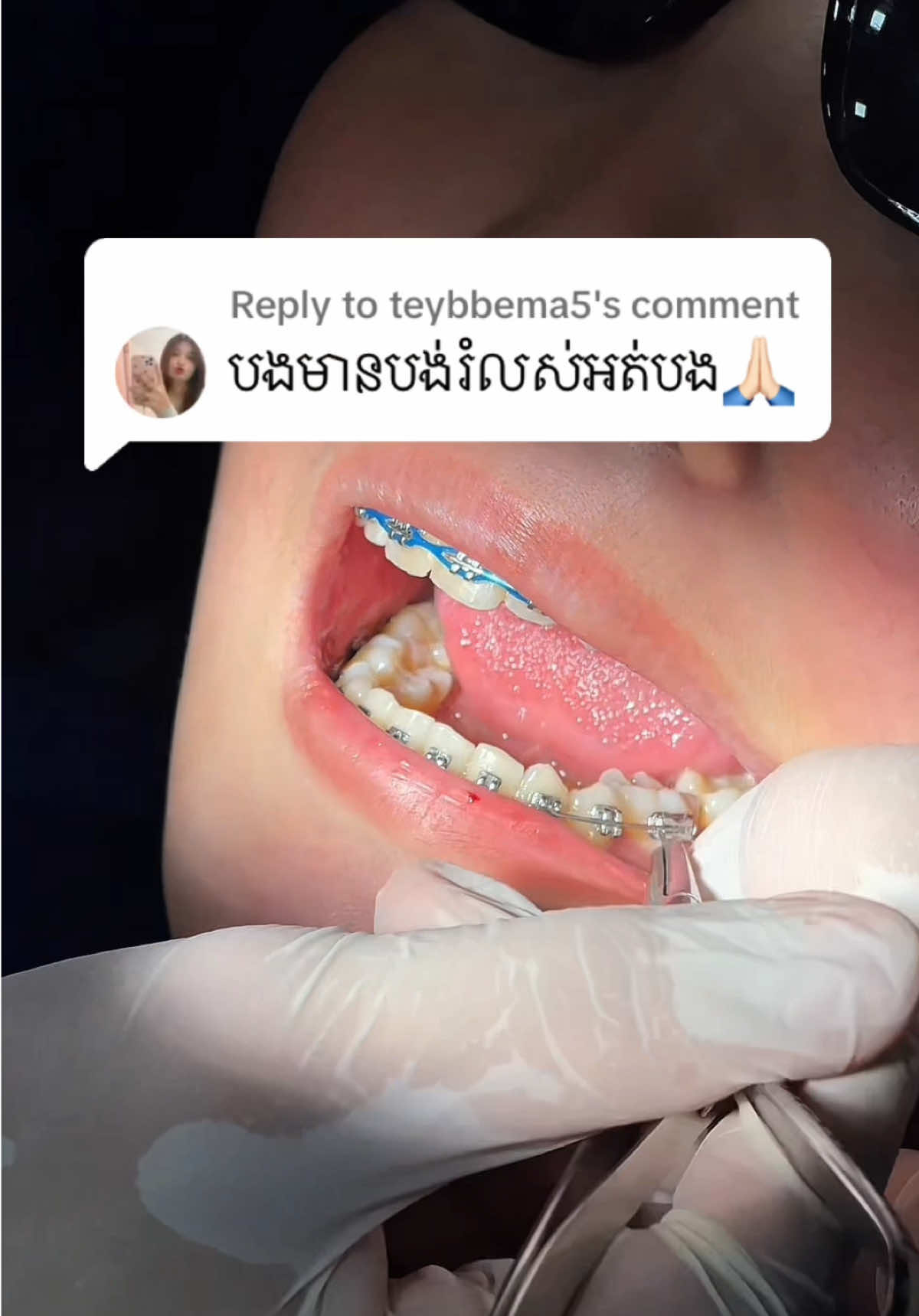 @BRIGHT SMILE DENTAL HOSPITAL
