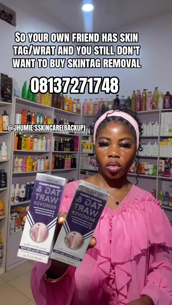 @OGUN STATE SKINCARE (ILARO)