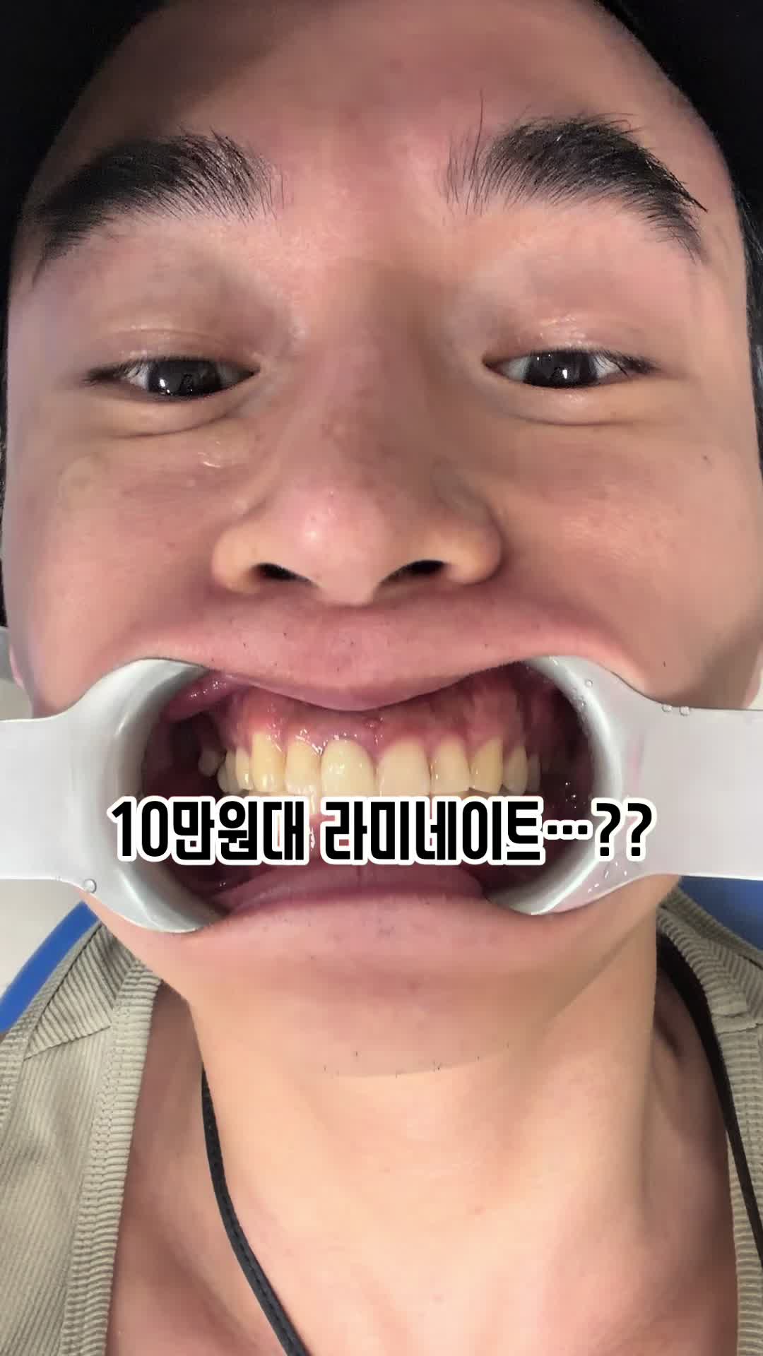 @치윤