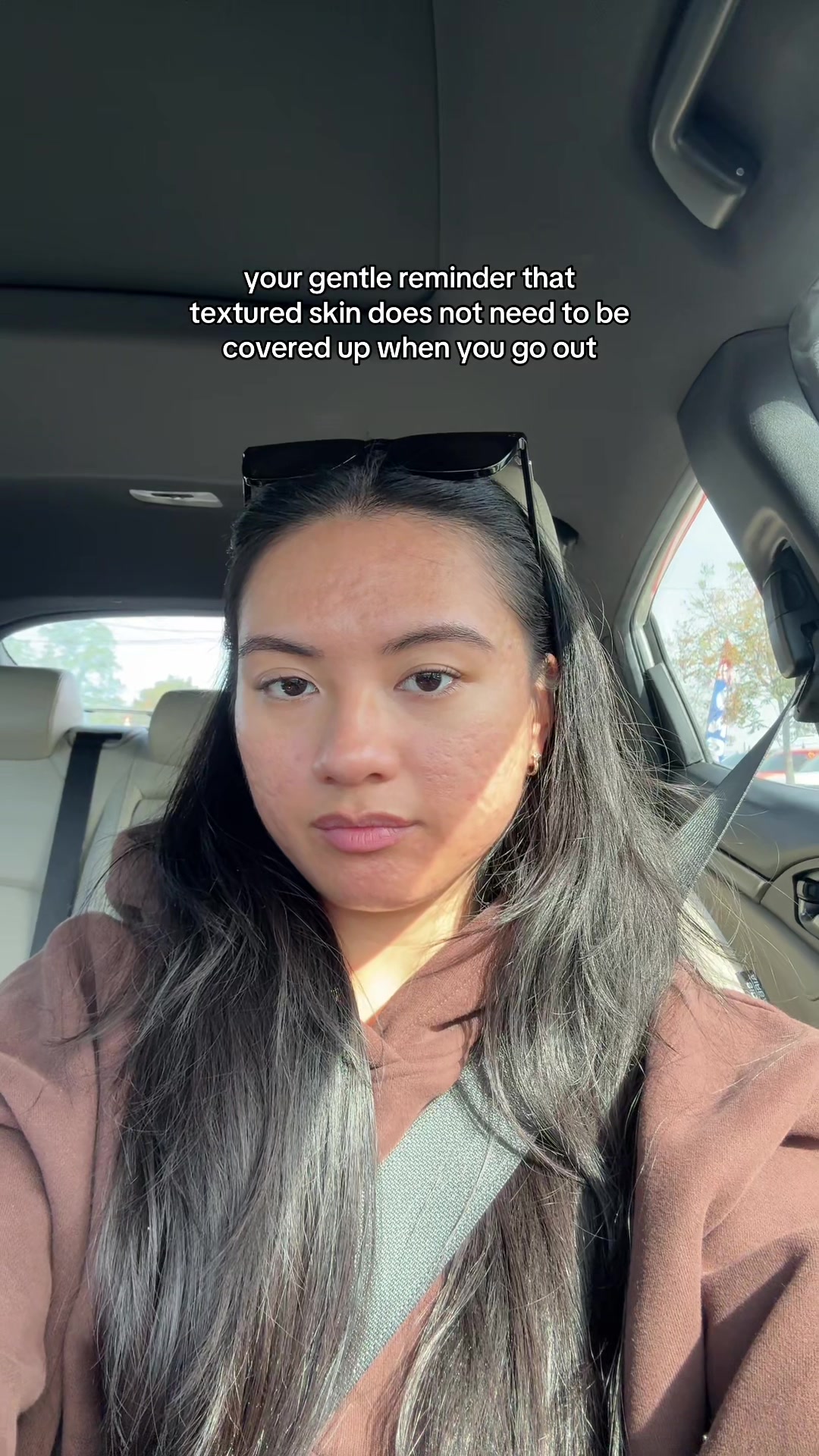 @jennilee • thatacnegirlie