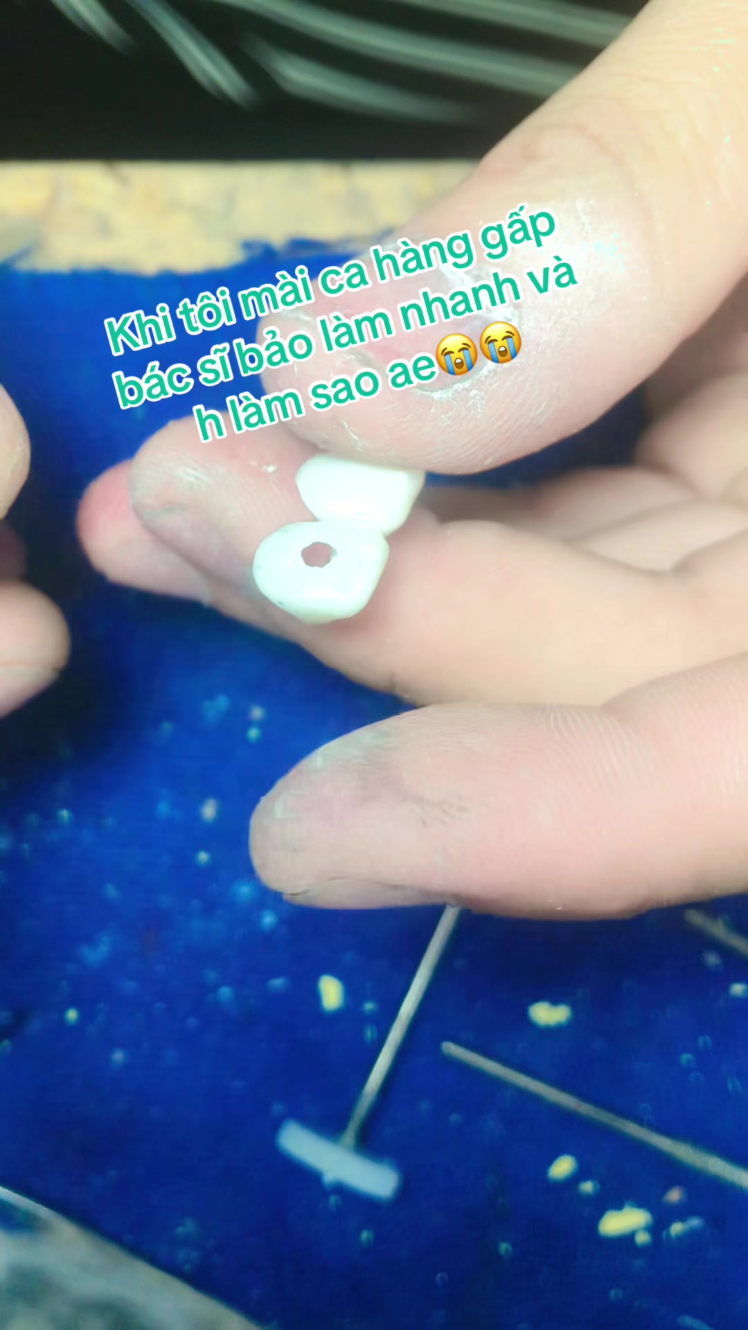 @Hùng răng sứ 🦷🦷