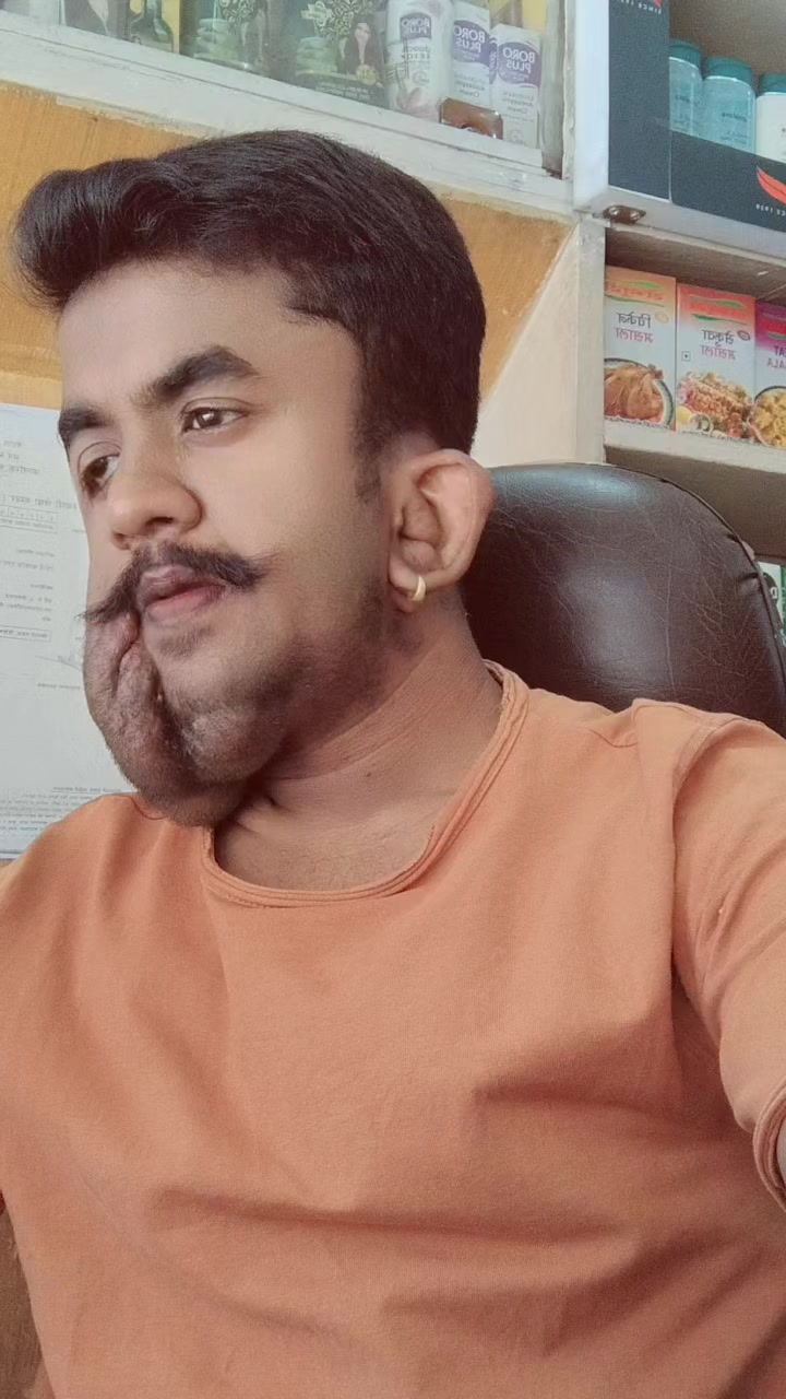 @Anidhya Vaish
