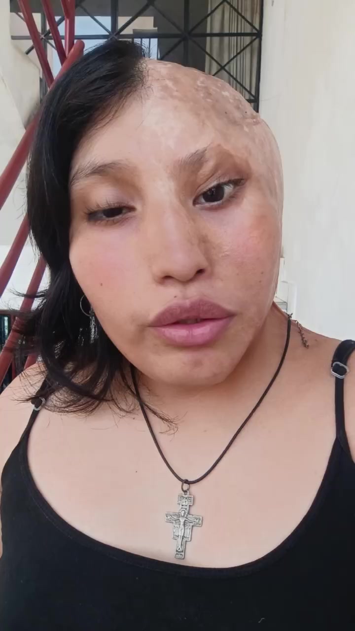 @Elizabeth Carri&oacute;n