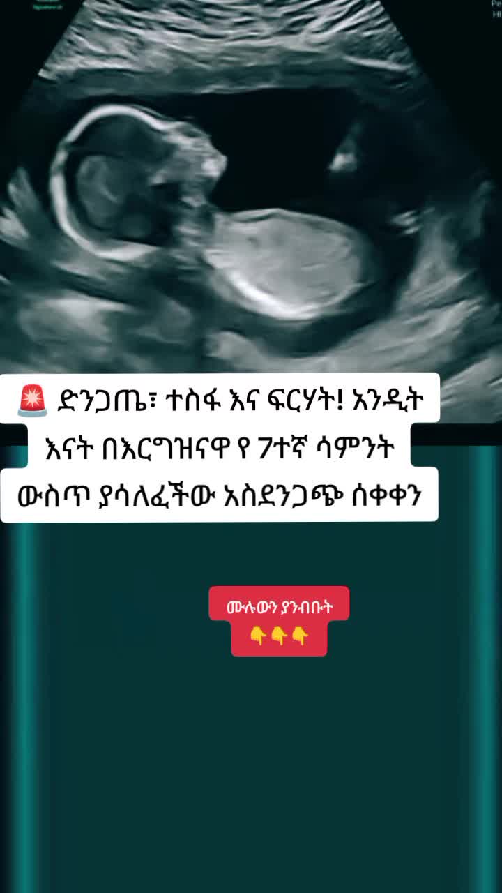 @ዶ/ር ትዕዛዙ(የማህፀን እና ፅንስ ሃኪም)