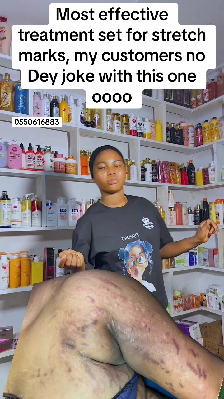 @Skincarevendorintamale