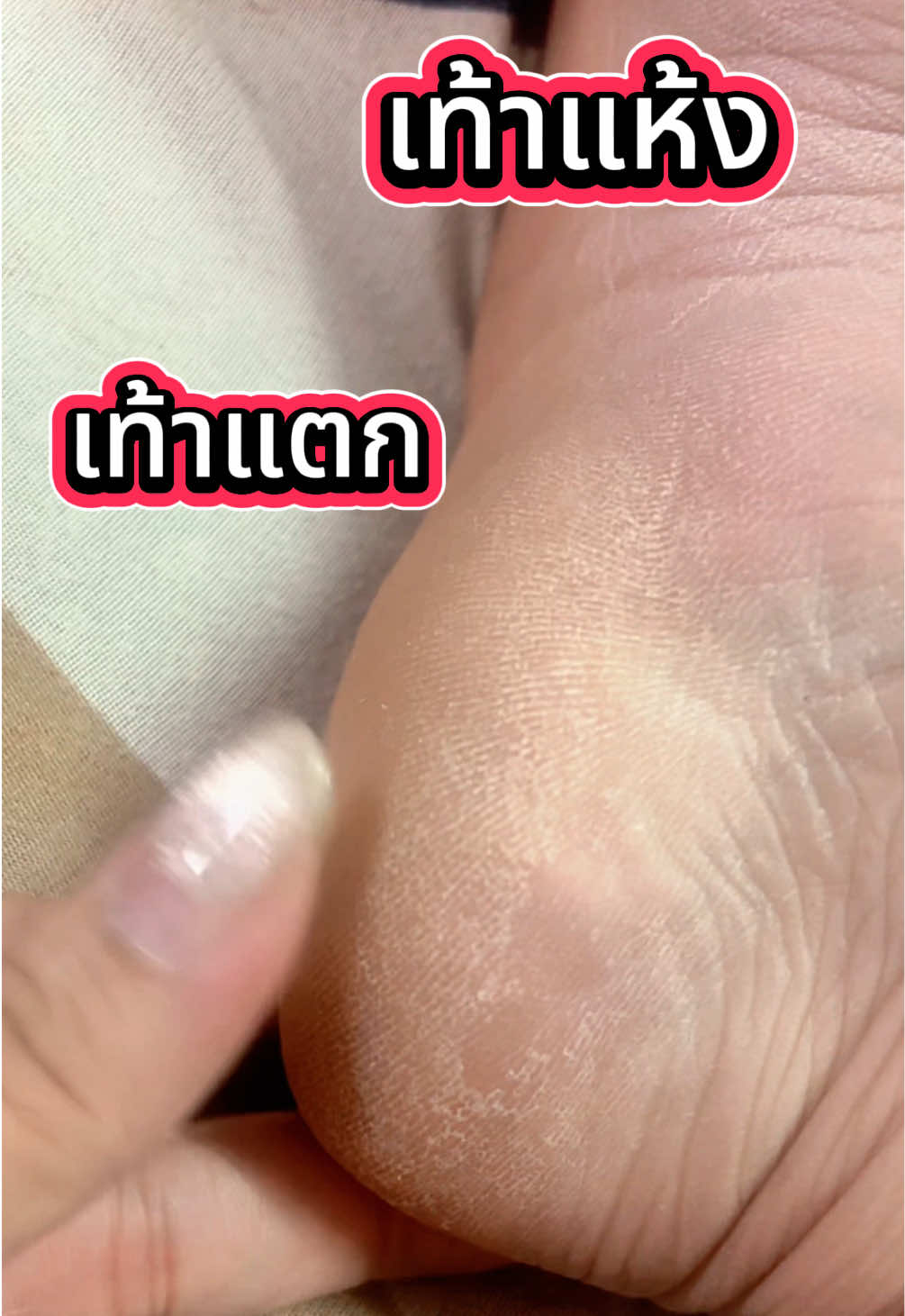 @✨จอยเกมบ้าอนิเมะ✨
