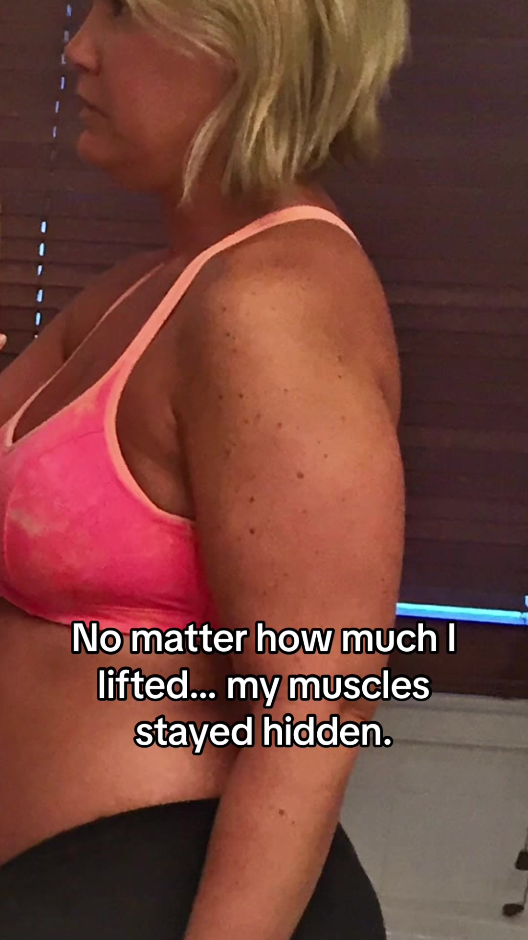 @Lipedema Warrior