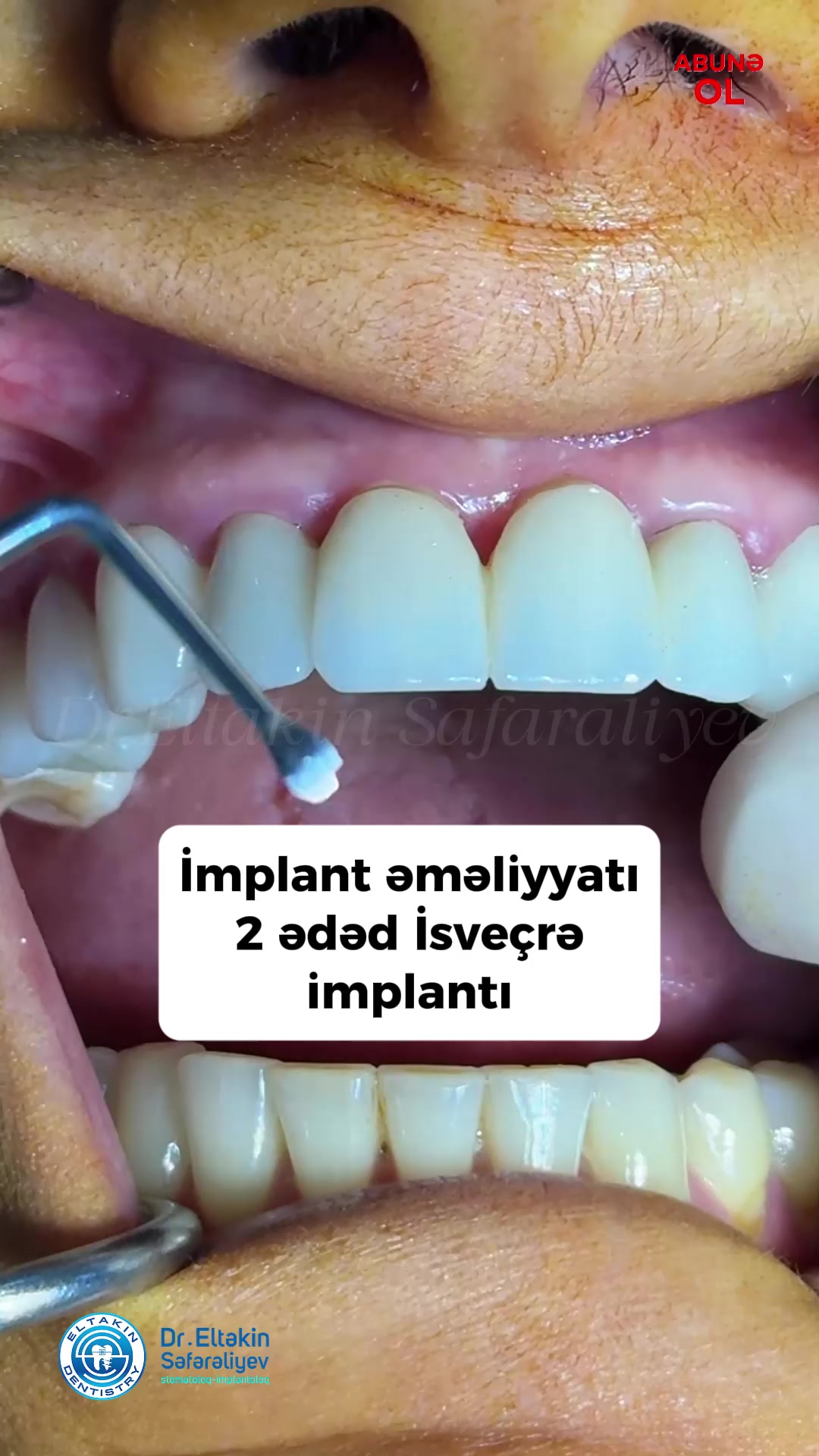 @eltakindentistry