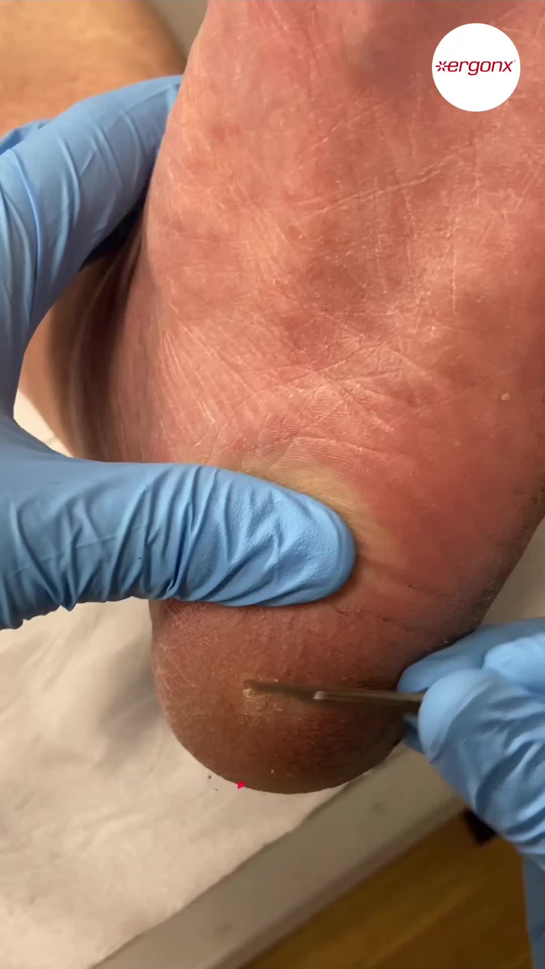 @ergonx