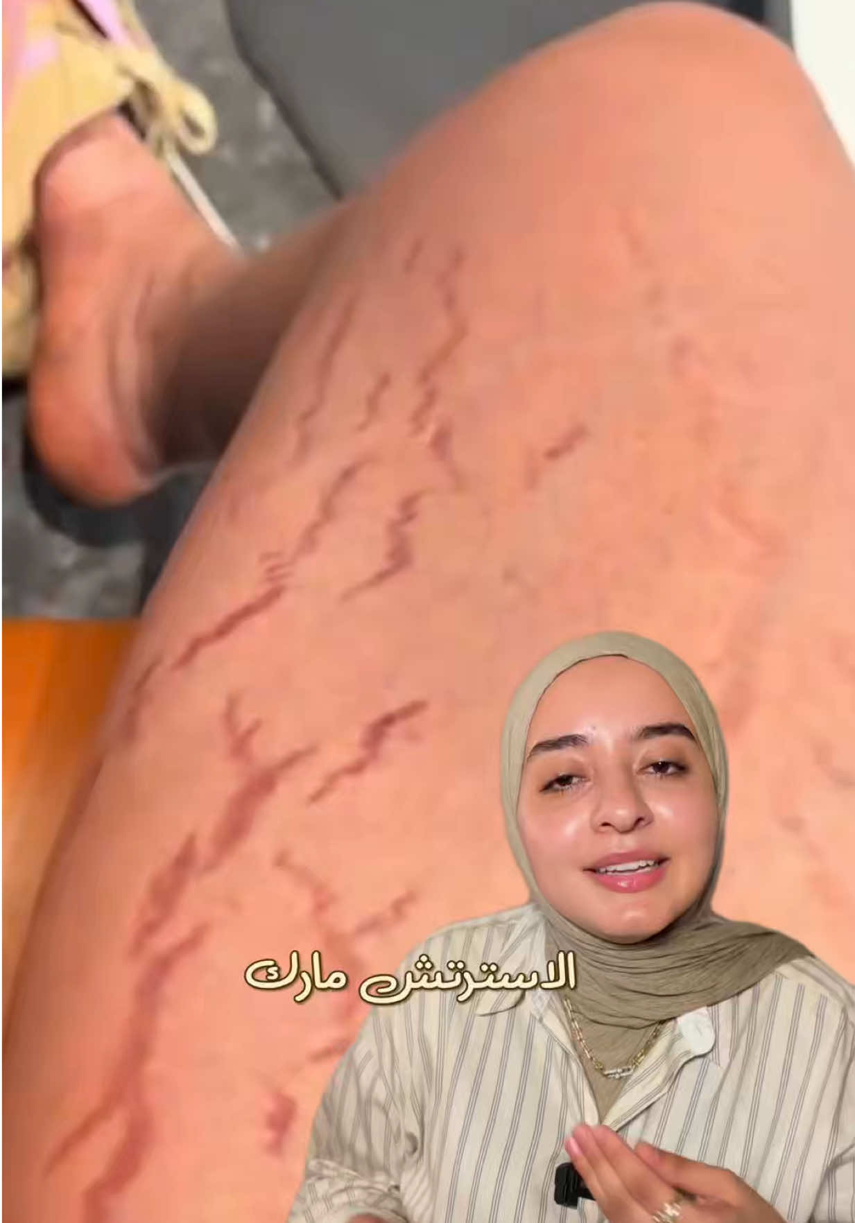 @Dr MeNna ali