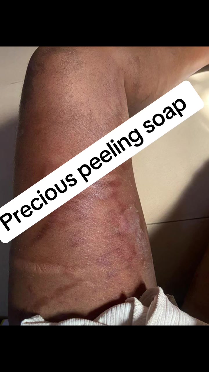 @@ Precious peeling soap